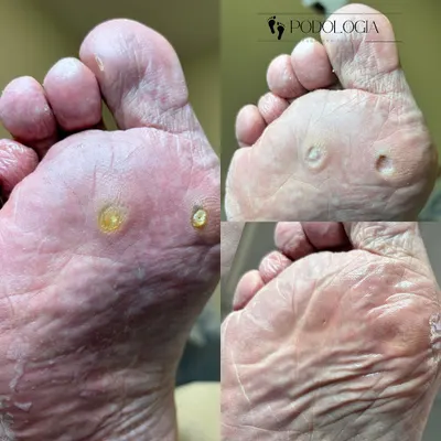 Podologia mgr Magdalena Pękała